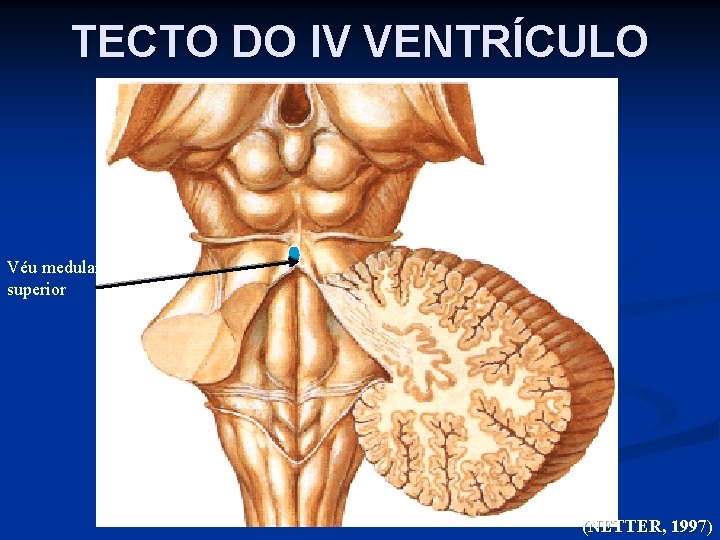 TECTO DO IV VENTRÍCULO Véu medular superior (NETTER, 1997) 