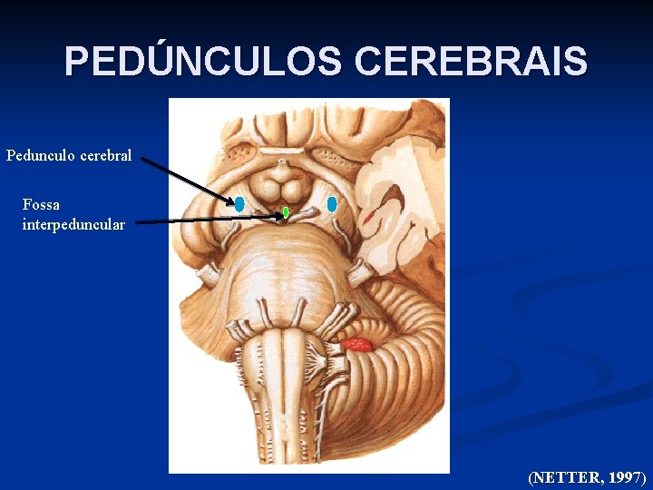 PEDÚNCULOS CEREBRAIS Pedunculo cerebral Fossa interpeduncular (NETTER, 1997) 