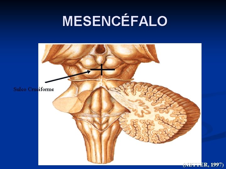MESENCÉFALO Sulco Cruciforme (NETTER, 1997) 