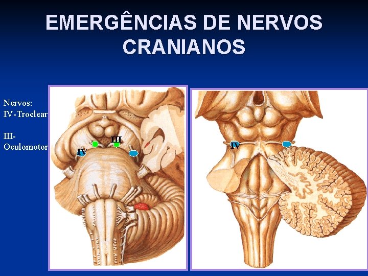 EMERGÊNCIAS DE NERVOS CRANIANOS Nervos: IV-Troclear IIIOculomotor III IV IV 