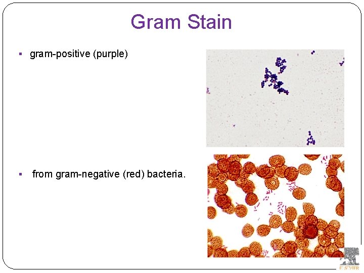 Gram Stain § gram-positive (purple) § from gram-negative (red) bacteria. 