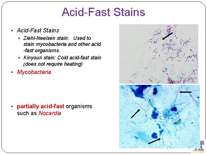 Acid-Fast Stains § Ziehl-Neelsen stain: Used to stain mycobacteria and other acid -fast organisms.