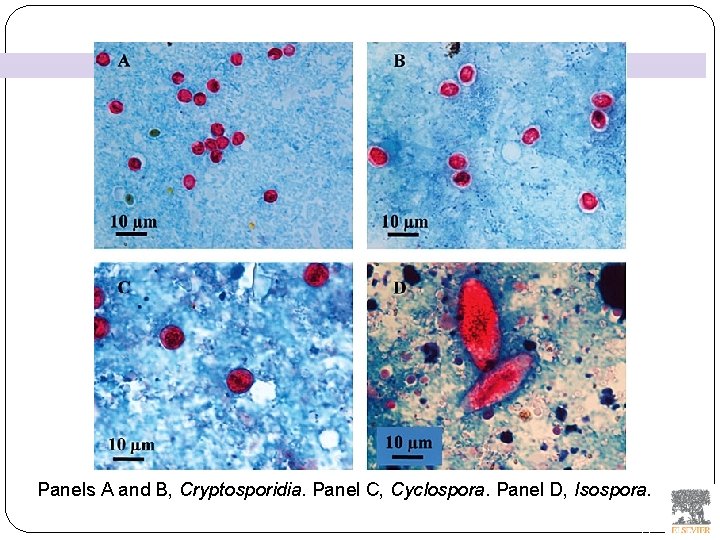 Panels A and B, Cryptosporidia. Panel C, Cyclospora. Panel D, Isospora. 23 