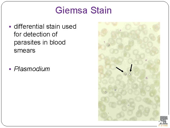 Giemsa Stain § differential stain used for detection of parasites in blood smears §