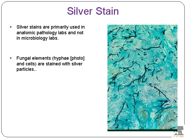 Silver Stain § Silver stains are primarily used in anatomic pathology labs and not