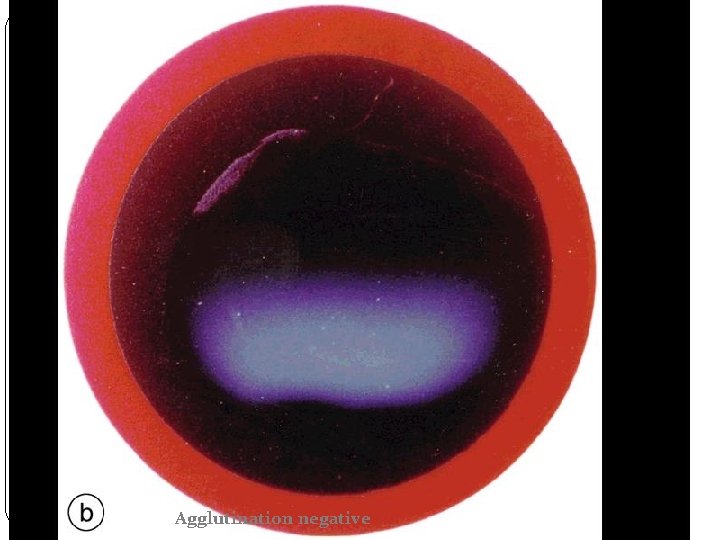 Agglutination negative 