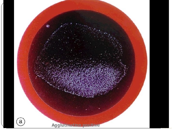 Agglutination positive 