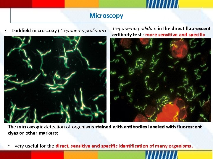 Microscopy • Darkfield microscopy (Treponema pallidum) Treponema pallidum in the direct fluorescent antibody test