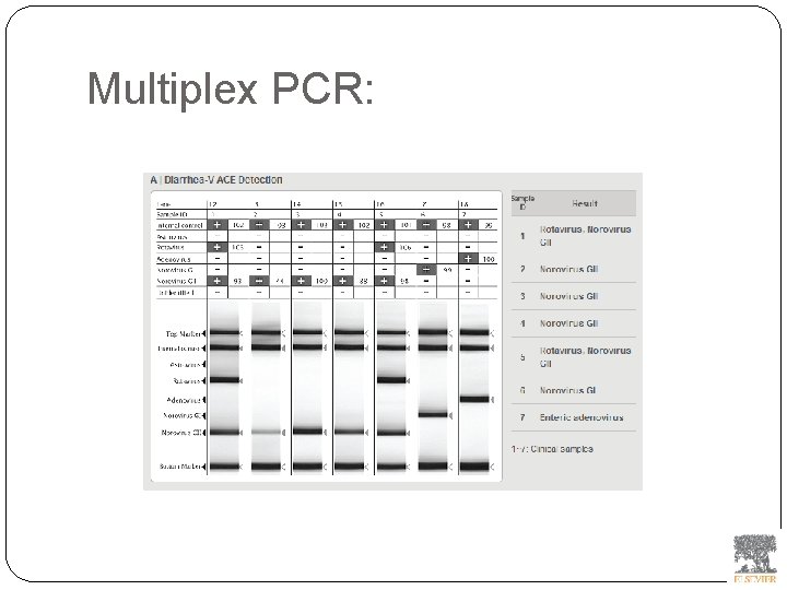 Multiplex PCR: 
