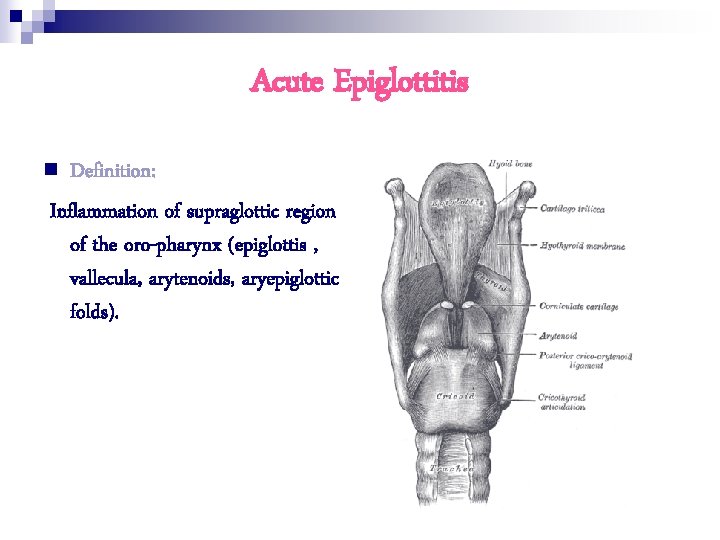 Acute Epiglottitis n Definition: Inflammation of supraglottic region of the oro-pharynx (epiglottis , vallecula,
