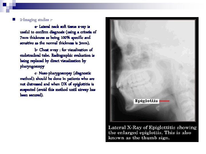 n 2 -Imaging studies : a- Lateral neck soft tissue x-ray is useful to