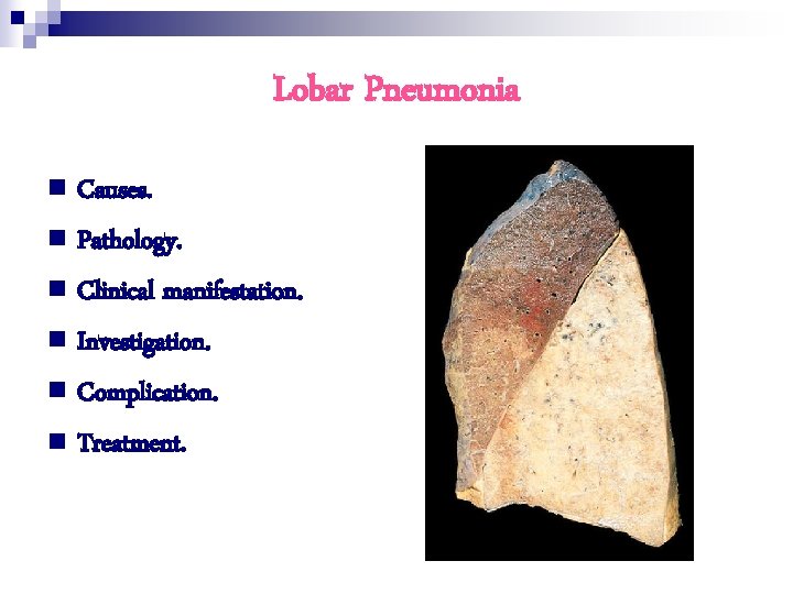 Lobar Pneumonia n Causes. n Pathology. n Clinical manifestation. n Investigation. n Complication. n