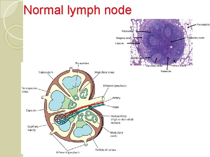 Normal lymph node 