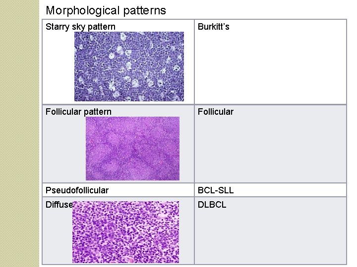 Morphological patterns Starry sky pattern Burkitt’s Follicular pattern Follicular Pseudofollicular BCL-SLL Diffuse DLBCL 