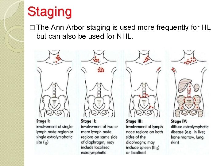 Staging � The Ann-Arbor staging is used more frequently for HL but can also