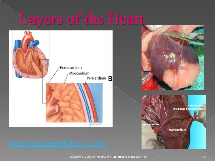 Layers of the Heart http: //youtu. be/w. XDB__v_DVc Copyright © 2007 by Mosby, Inc.