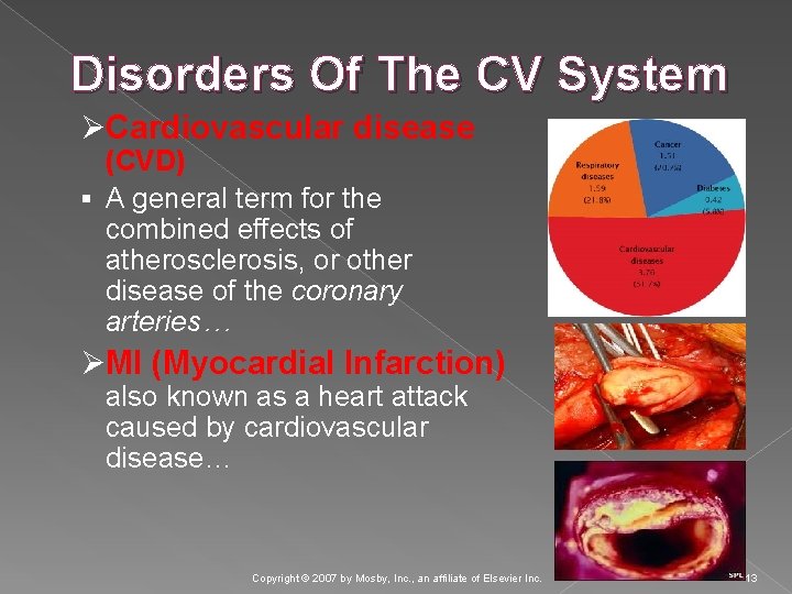 Disorders Of The CV System ØCardiovascular disease (CVD) § A general term for the