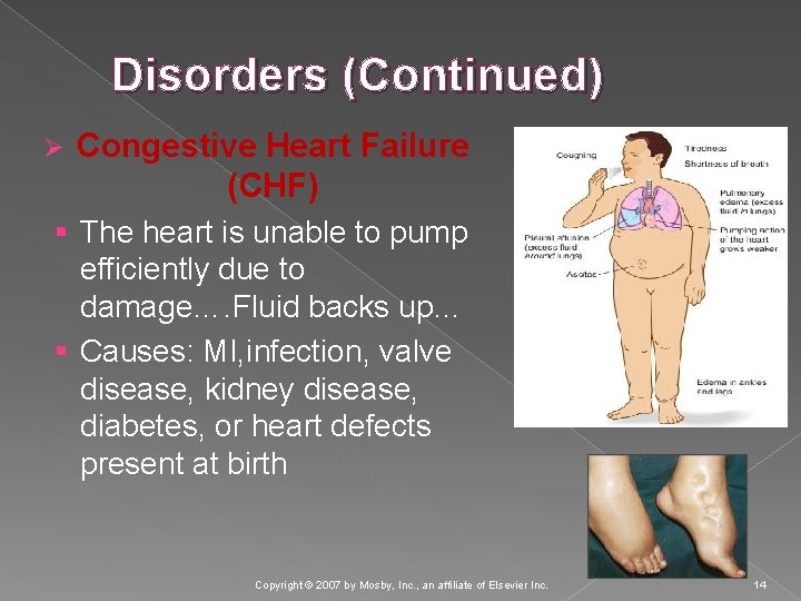 Disorders (Continued) Ø Congestive Heart Failure (CHF) § The heart is unable to pump