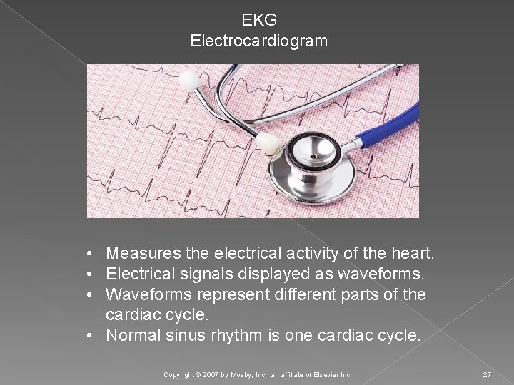 EKG Electrocardiogram • Measures the electrical activity of the heart. • Electrical signals displayed