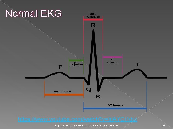 Normal EKG https: //www. youtube. com/watch? v=lrj. AYCi 1 du. I Copyright © 2007