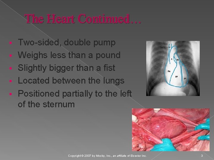 The Heart Continued… § § § Two-sided, double pump Weighs less than a pound