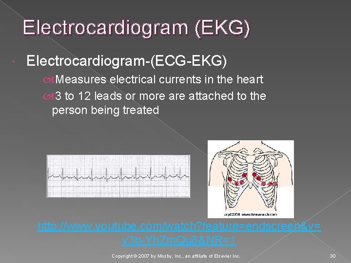 Electrocardiogram (EKG) Electrocardiogram-(ECG-EKG) Measures electrical currents in the heart 3 to 12 leads or