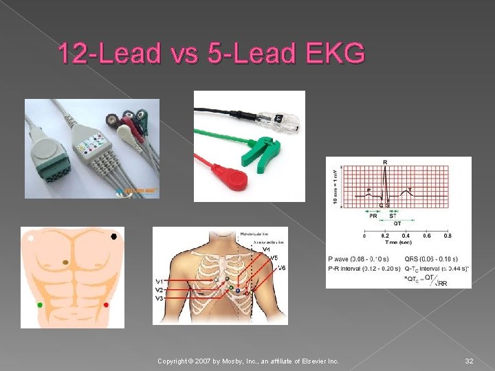 12 -Lead vs 5 -Lead EKG Copyright © 2007 by Mosby, Inc. , an