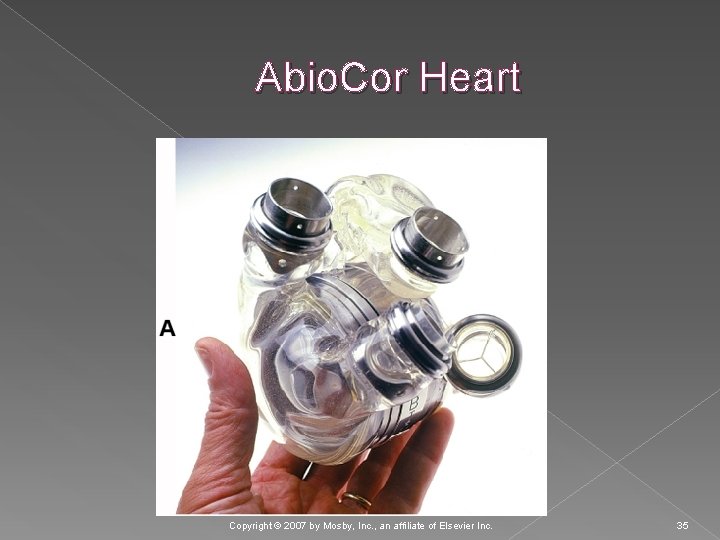 Abio. Cor Heart Copyright © 2007 by Mosby, Inc. , an affiliate of Elsevier