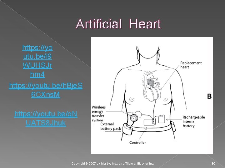 Artificial Heart https: //yo utu. be/i 9 WUHSJr hm 4 https: //youtu. be/h. Bje.