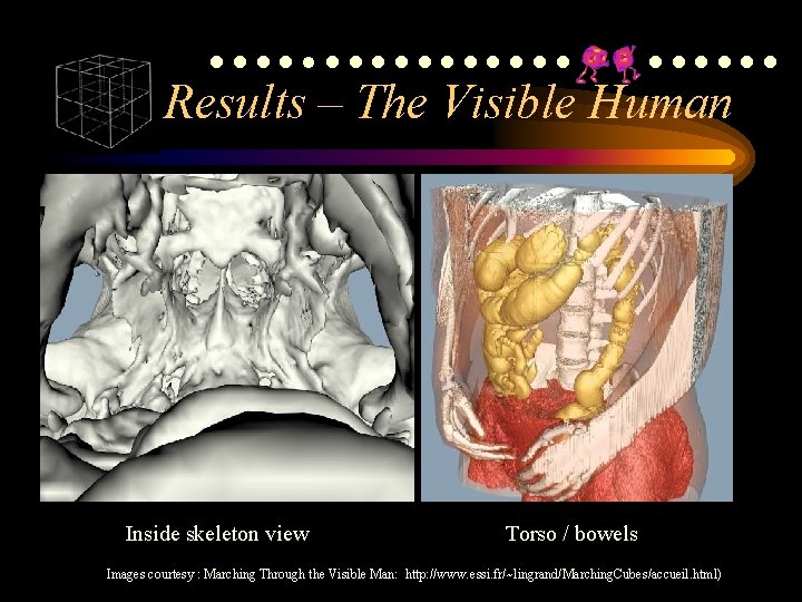 ●●●●●●●●●●●●● Results – The Visible Human Inside skeleton view Torso / bowels Images courtesy ●●●●●●●●●●●●● Results – The Visible Human Inside skeleton view Torso / bowels Images courtesy