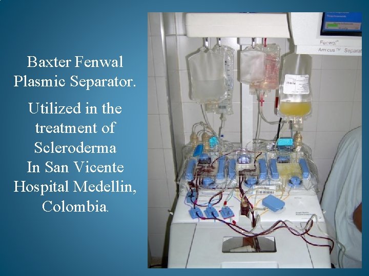 Baxter Fenwal Plasmic Separator. Utilized in the treatment of Scleroderma In San Vicente Hospital