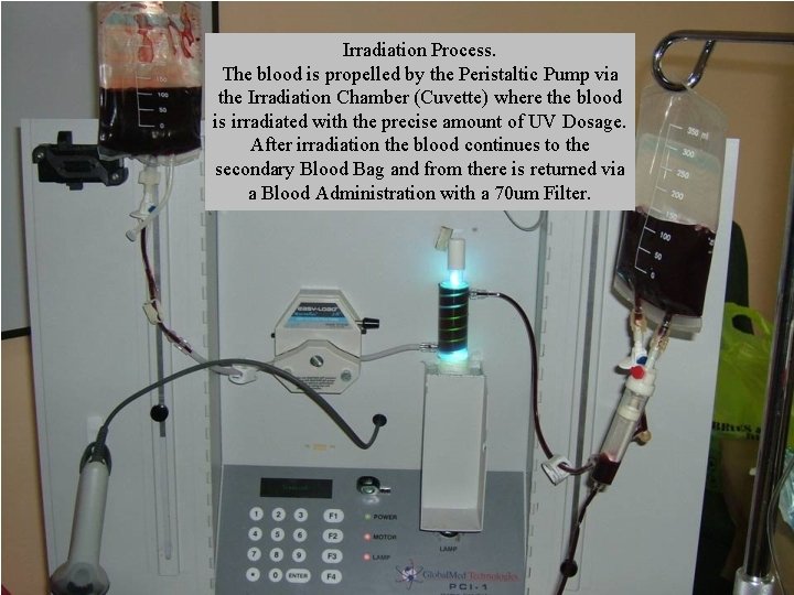 Irradiation Process. The blood is propelled by the Peristaltic Pump via the Irradiation Chamber