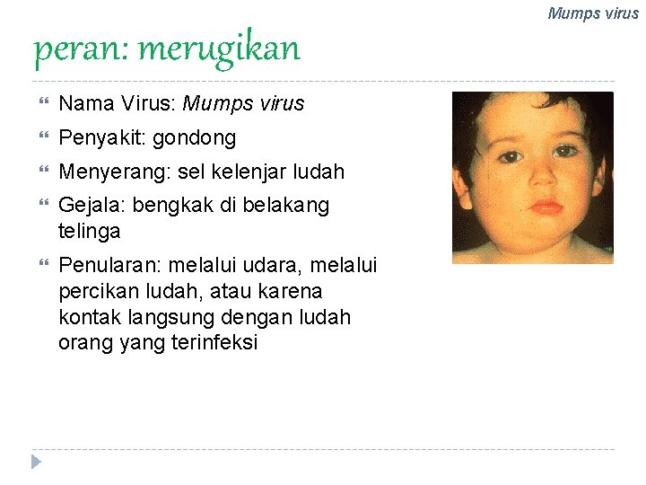 Mumps virus peran: merugikan Nama Virus: Mumps virus Penyakit: gondong Menyerang: sel kelenjar ludah