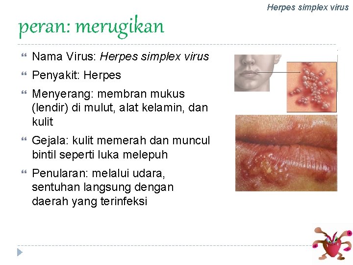 Herpes simplex virus peran: merugikan Nama Virus: Herpes simplex virus Penyakit: Herpes Menyerang: membran