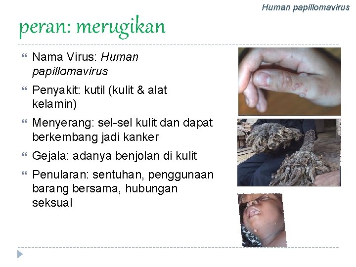 Human papillomavirus peran: merugikan Nama Virus: Human papillomavirus Penyakit: kutil (kulit & alat kelamin)