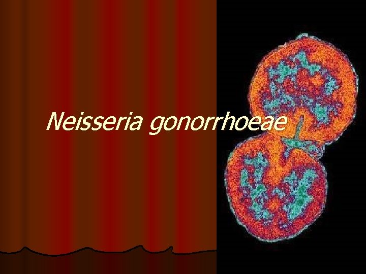Neisseria gonorrhoeae Neisseria gonorrhoeae