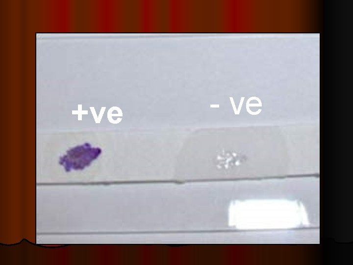 +ve - ve +ve - ve