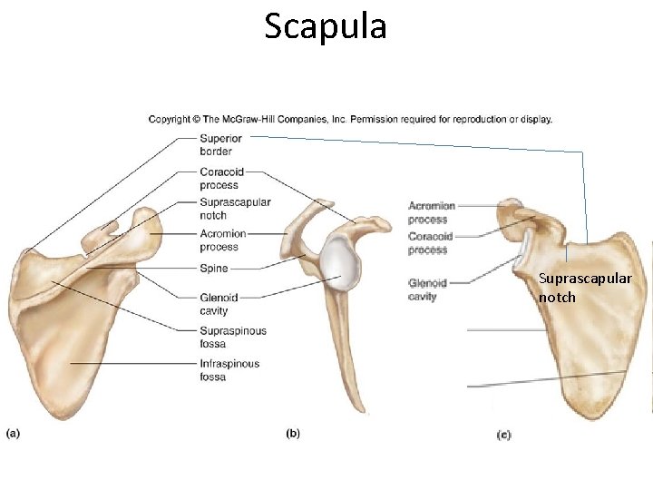Scapula Suprascapular notch Scapula Suprascapular notch