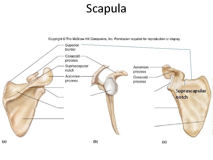 Scapula Suprascapular notch 