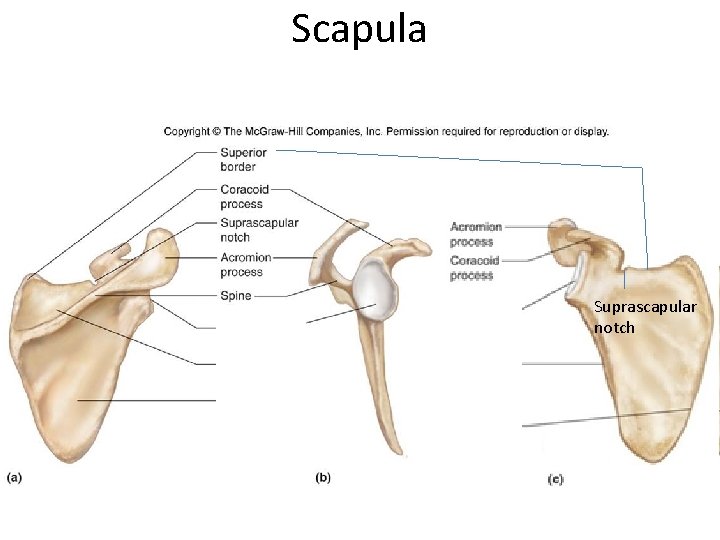 Scapula Suprascapular notch 