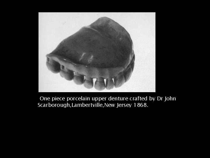 One piece porcelain upper denture crafted by Dr John Scarborough, Lambertville, New Jersey 1868.