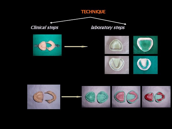 TECHNIQUE Clinical steps laboratory steps 