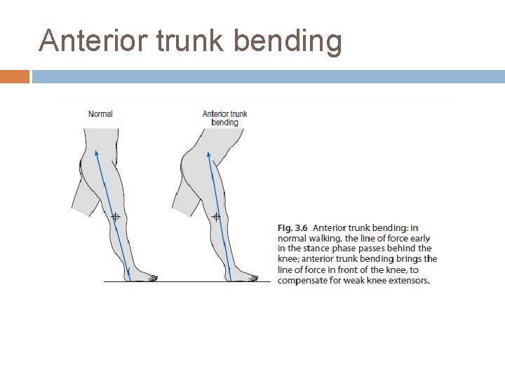 Anterior trunk bending Anterior trunk bending