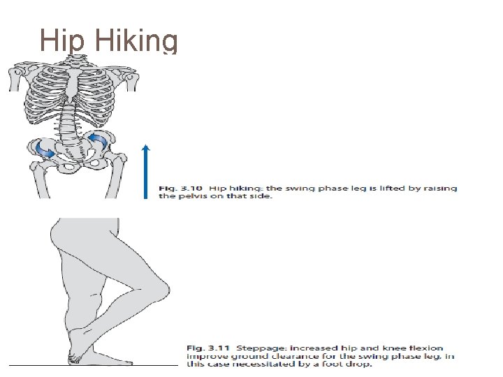 Hip Hiking 