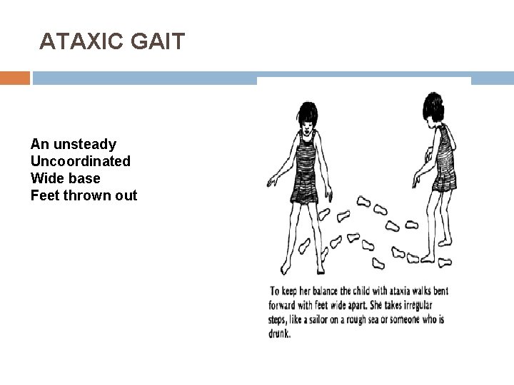 ATAXIC GAIT An unsteady Uncoordinated Wide base Feet thrown out 