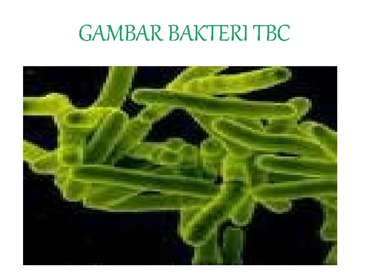 GAMBAR BAKTERI TBC 