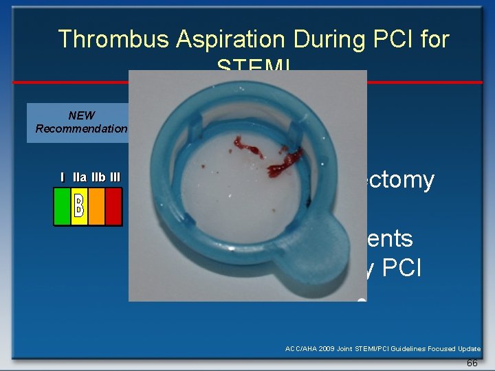 Thrombus Aspiration During PCI for STEMI NEW Recommendation I IIa IIb III Aspiration thrombectomy