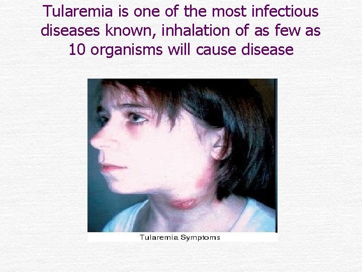 Tularemia is one of the most infectious diseases known, inhalation of as few as