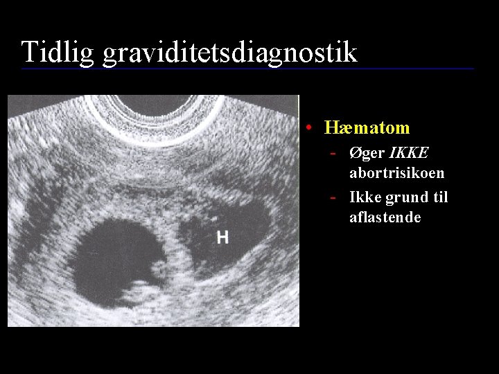 Tidlig graviditetsdiagnostik • Hæmatom - Øger IKKE abortrisikoen - Ikke grund til aflastende regime