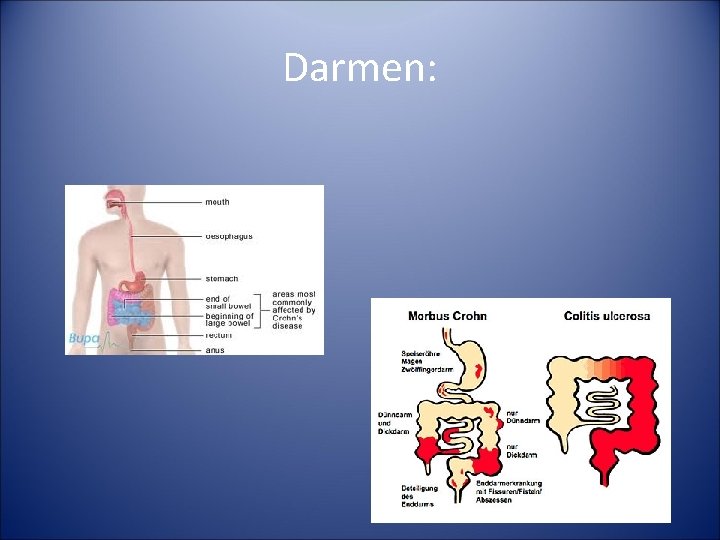 Darmen: 